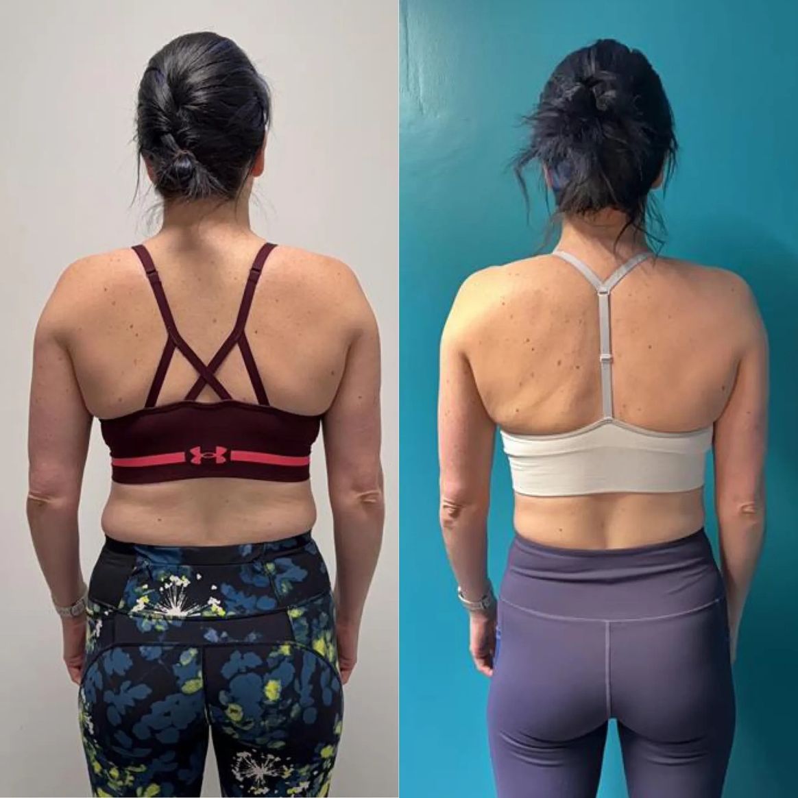 Female back view transformation showing reduced back fat after strength coaching